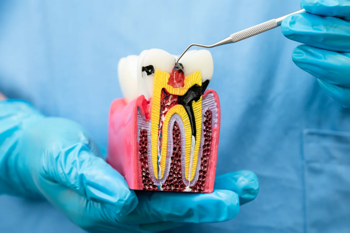 Dental House Velletri - Endodonzia